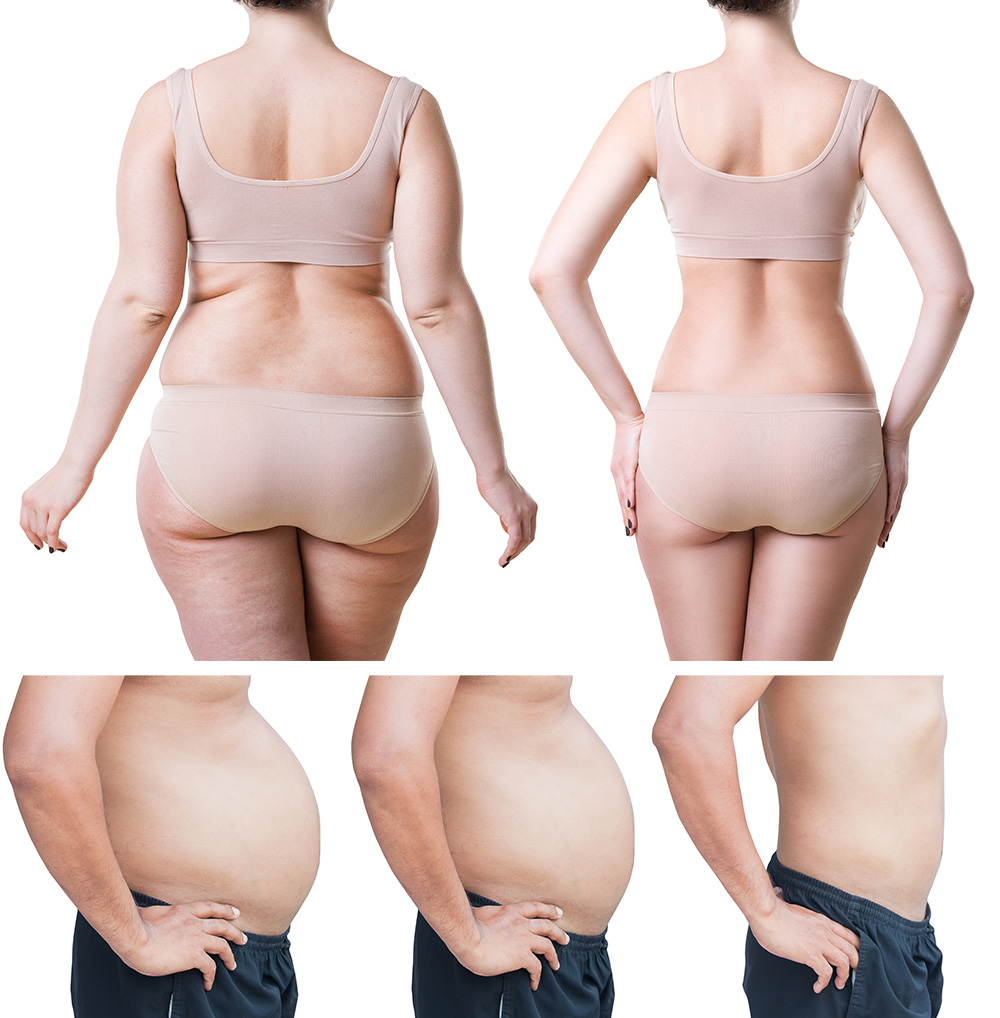 The image showcases weight loss progress with two sets of before-and-after comparisons. The top row highlights a person's back view, illustrating changes in body shape. Meanwhile, the bottom row focuses on a person's abdomen across three stages of weight reduction.